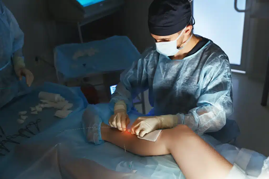 A high-definition image of a patient undergoing Endovenous Laser Therapy (EVLT) for varicose veins, showing the precision and effectiveness of the laser technology used in modern vein treatments.